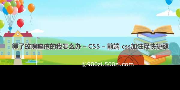 得了玫瑰痤疮的我怎么办 – CSS – 前端 css加注释快捷键